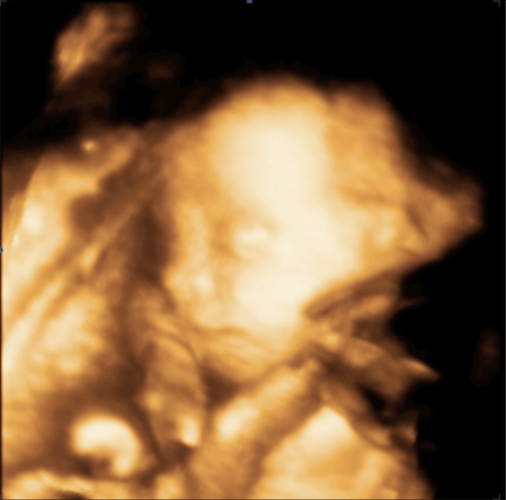 Een 3D echo van de baby op 23 weken